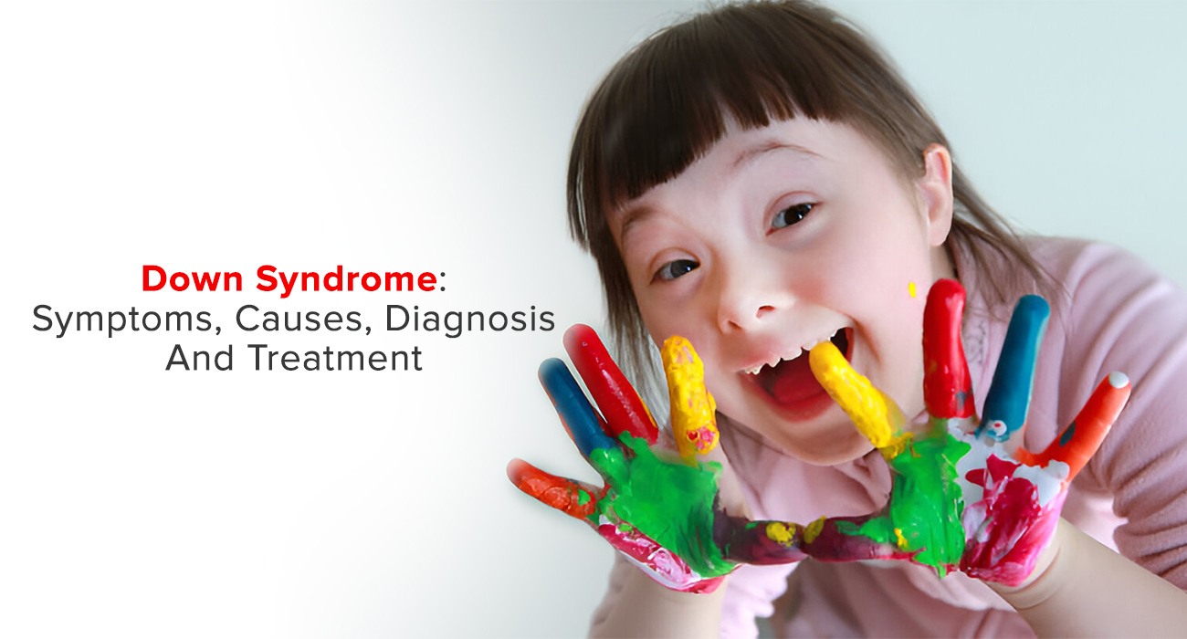 Down Syndrome: Symptoms, Causes, Diagnosis And Treatment